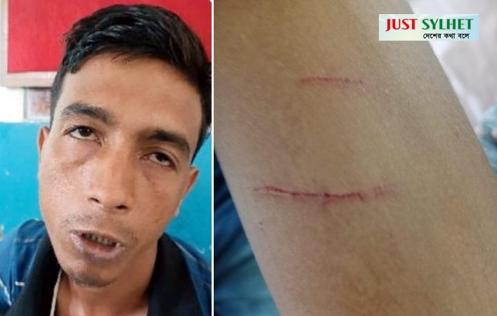 কোম্পানীগঞ্জে দিনদুপুরে বিকাশ ব্যবসায়ীর ভাইকে কুপিয়ে ২ লাখ টাকা ছিনতাই!